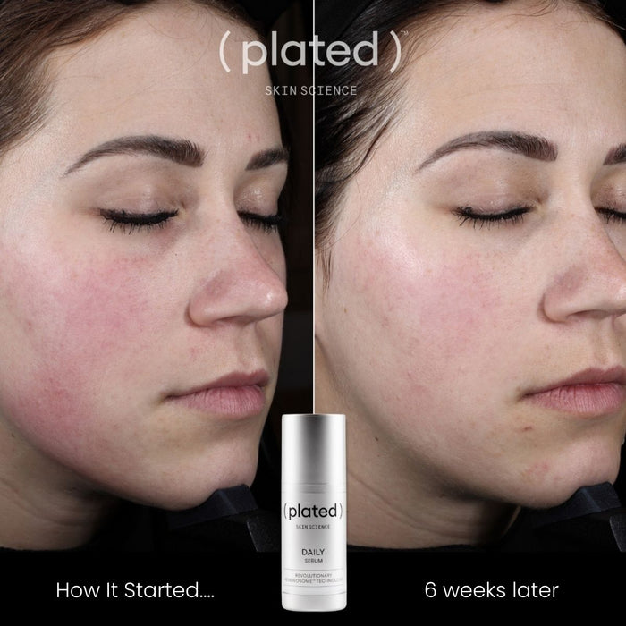 Plated DAILY Serum - 30ml