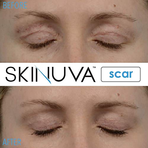 Skinuva® Next Generation Advanced Scar Cream 1.7 OZ