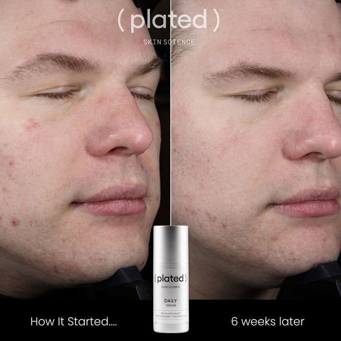Plated DAILY Serum - 30ml
