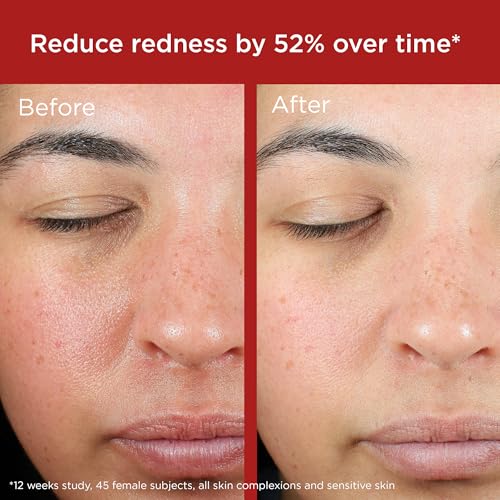 EltaMD UV Skin Recovery Green Tint SPF 50 1.7 oz