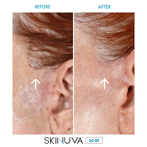 Skinuva® Next Generation Advanced Scar Cream 1.7 OZ