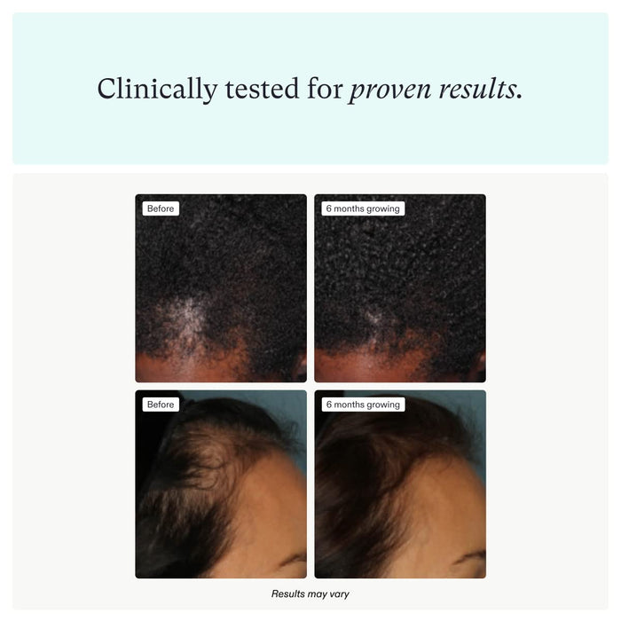 Nutrafol Women's Hair Growth Supplements 1 Refill Pouch 1 month supply