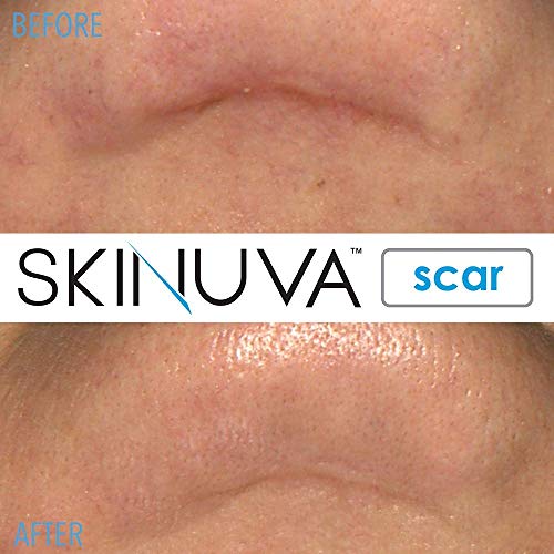 Skinuva® Next Generation Advanced Scar Cream 1.7 OZ