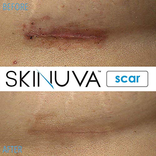 Skinuva® Next Generation Advanced Scar Cream 1.7 OZ