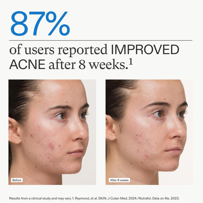 Nutrafol Skin Acne Supplement for Women 1-Month Supply