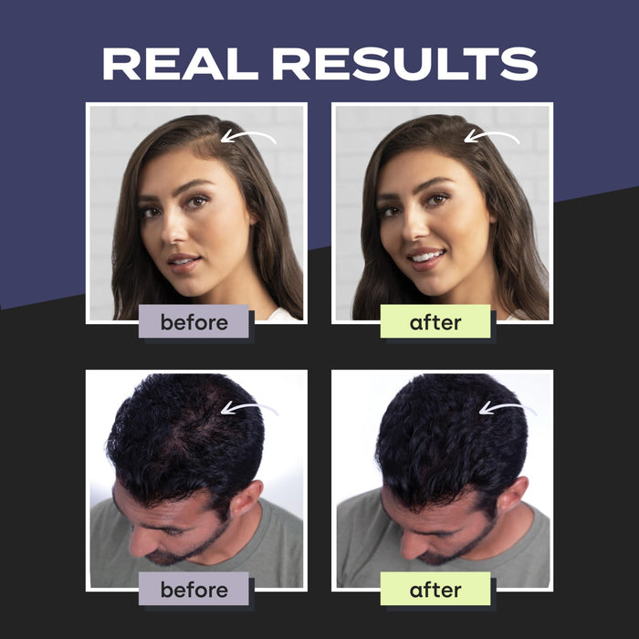 Toppik Hair Building Fibers, DARK BROWN, 12g  Fuller Looking Hair