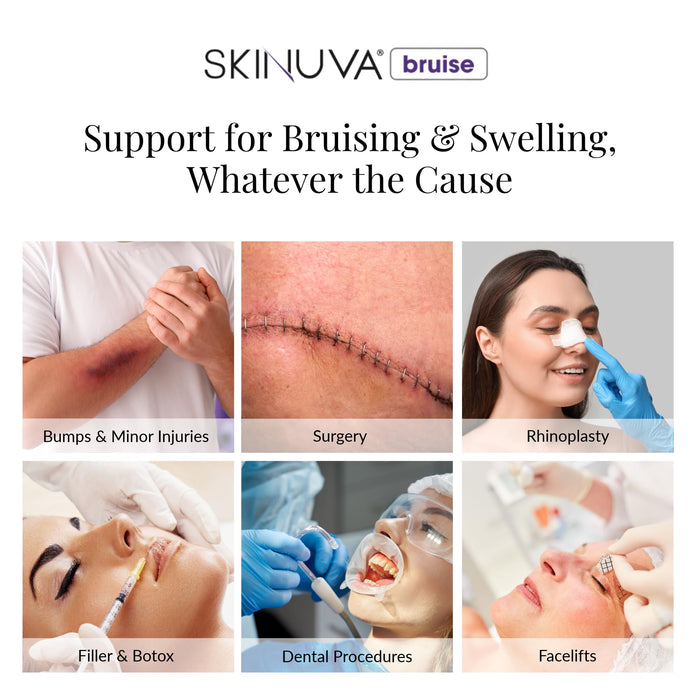 Skinuva® Bruise Tablets (7-Day Treatment) - 14 veg Capsules