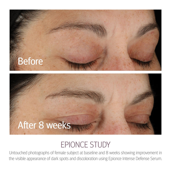 Epionce Intense Defense Serum - 1 oz/30 ml