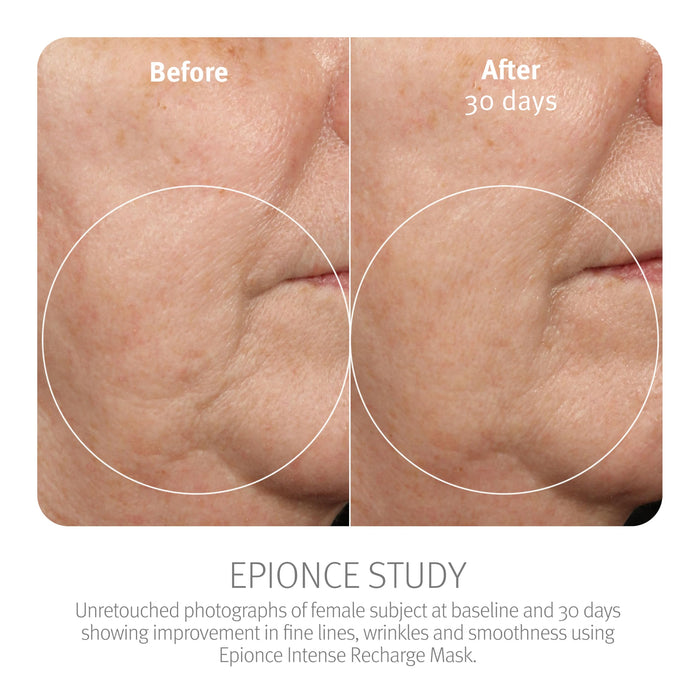 Epionce Intense Recharge Mask - Anti-Aging Clay Face Mask for All Skin Types 50 g/1.7 oZ