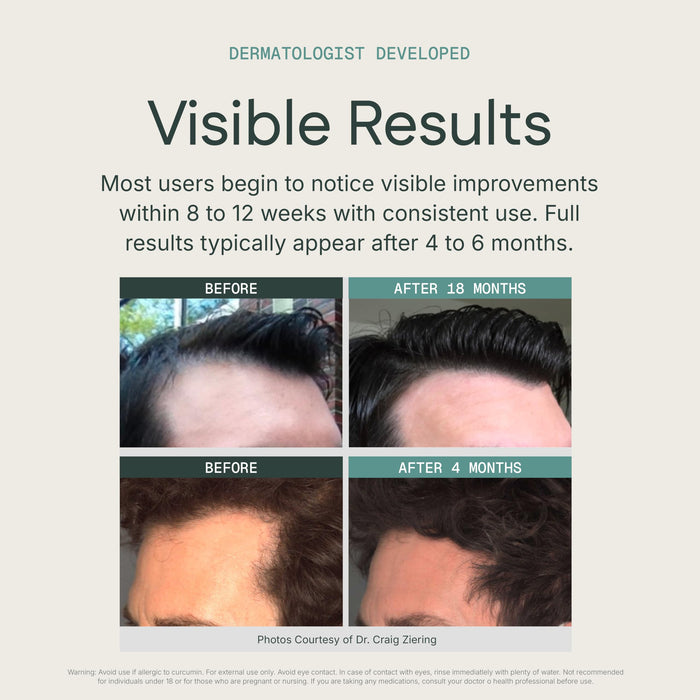 KeraFactor Scalp Stimulating Solution - 7 Biomimetic Growth Factors - 50 ml