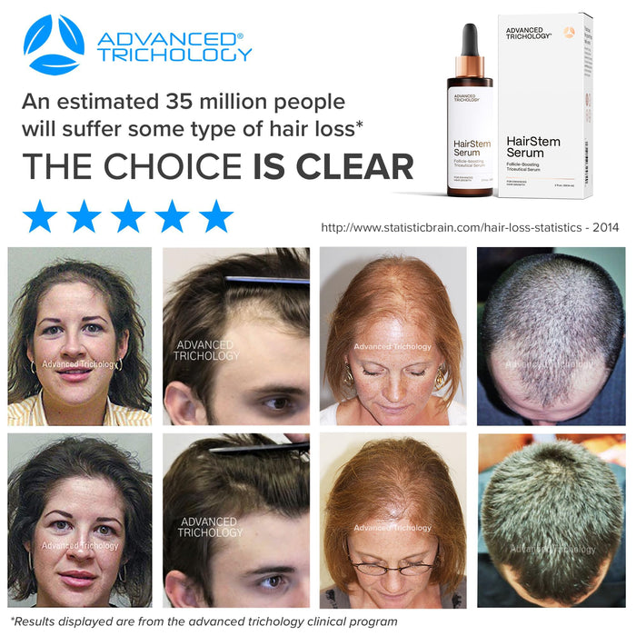 HairStem Follicle-boosting Triceutical Serum for Thicker Fuller Hair 2 fl Oz