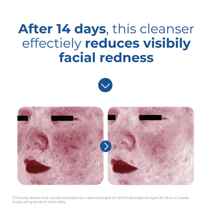 EltaMD Skin Recovery Amino Acid Foaming Cleanser 5 oz