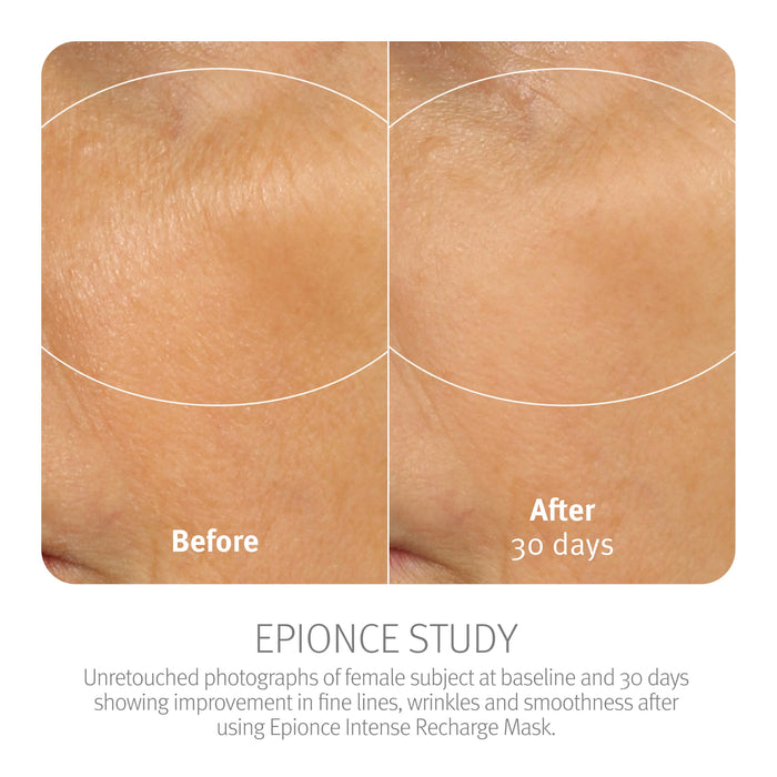 Epionce Intense Recharge Mask - Anti-Aging Clay Face Mask for All Skin Types 50 g/1.7 oZ