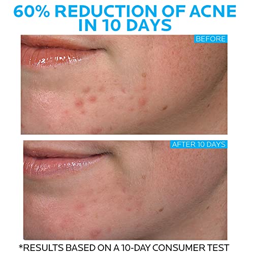 La Roche-Posay Effaclar Duo Acne Spot Treatment 1.35 Fl Oz